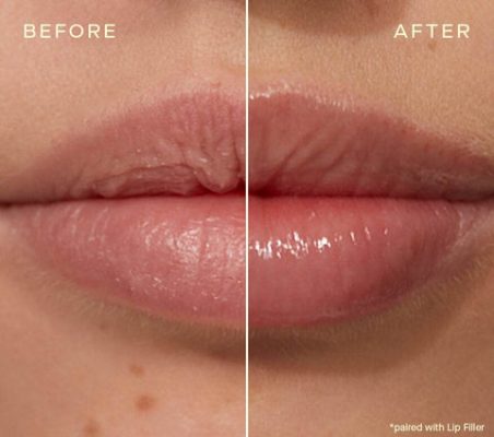 FULL LIPS – Lips Balm - BUZE VOLUPTOASE INSTANTANEU, PLINE, SENZUALE ȘI CATIFELATE – HIDRATARE PROFUNDĂ CARE DUREAZĂ