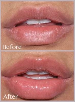 FULL LIPS – Lips Balm - BUZE VOLUPTOASE INSTANTANEU, PLINE, SENZUALE ȘI CATIFELATE – HIDRATARE PROFUNDĂ CARE DUREAZĂ