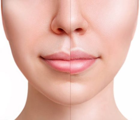 FULL LIPS – Lips Balm - BUZE VOLUPTOASE INSTANTANEU, PLINE, SENZUALE ȘI CATIFELATE – HIDRATARE PROFUNDĂ CARE DUREAZĂ