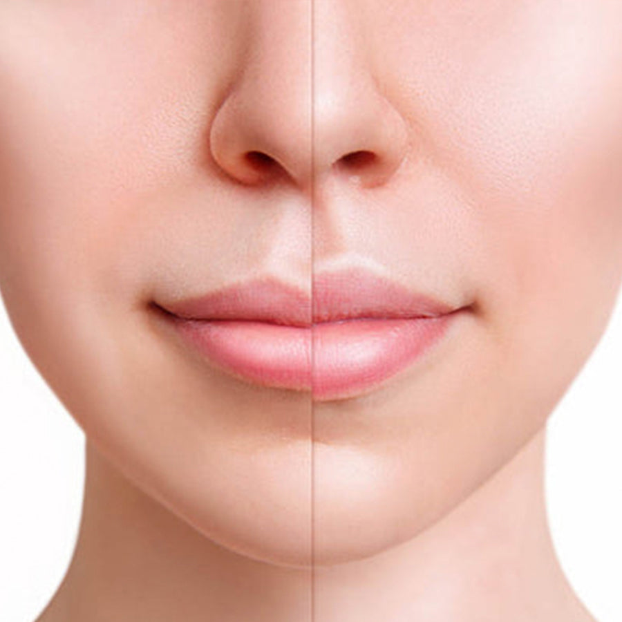 FULL LIPS – Lips Balm - BUZE VOLUPTOASE INSTANTANEU, PLINE, SENZUALE ȘI CATIFELATE – HIDRATARE PROFUNDĂ CARE DUREAZĂ